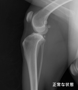 レントゲン 正常な状態