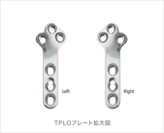 TPLO プレートイメージ図