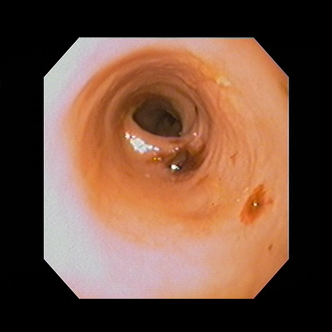 消化管検査画像