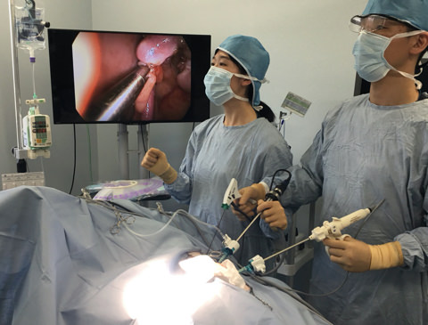 腹腔鏡（ラパロ）手術での手術画像