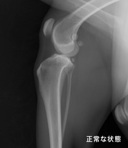 レントゲン 正常な状態
