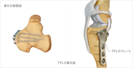 TPLO 解説図