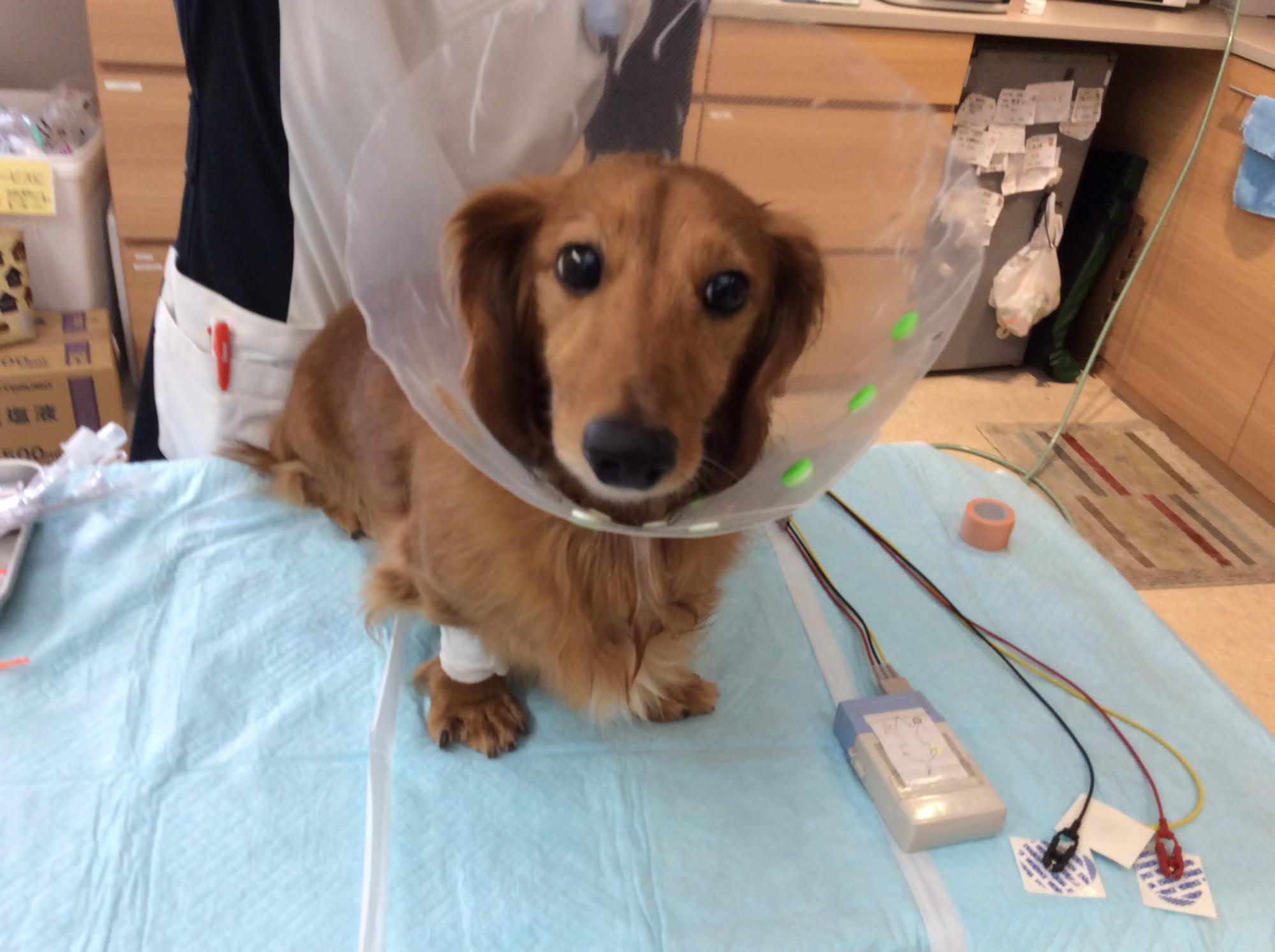 直腸ポリープをポリペクトミーで治療した「しのちゃん